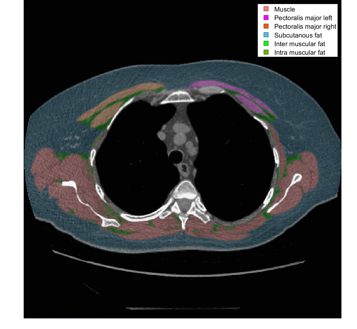 Et billede af thorax